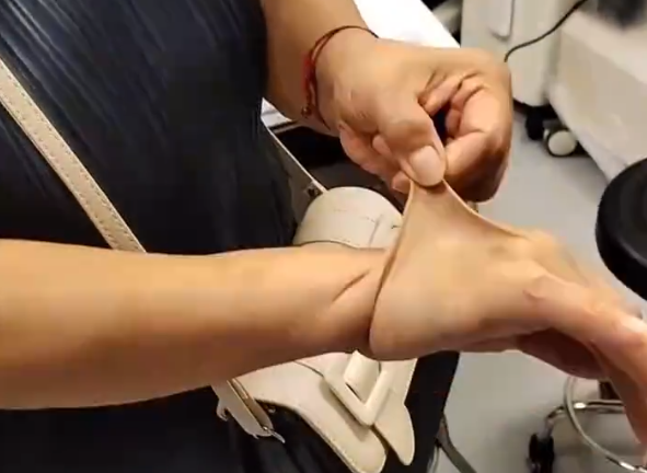 女子得罕见病：皮肤可拉伸如橡皮人 胞姐首例确诊